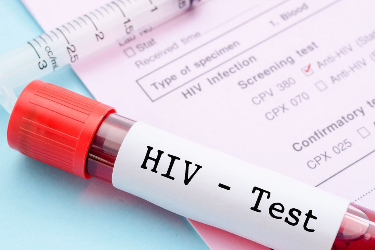 Республиканскую акцию по профилактике ВИЧ-инфекции проведут 25 ноября Минздрав и ГАИ